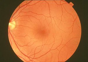 retina netvlies menselijk oog