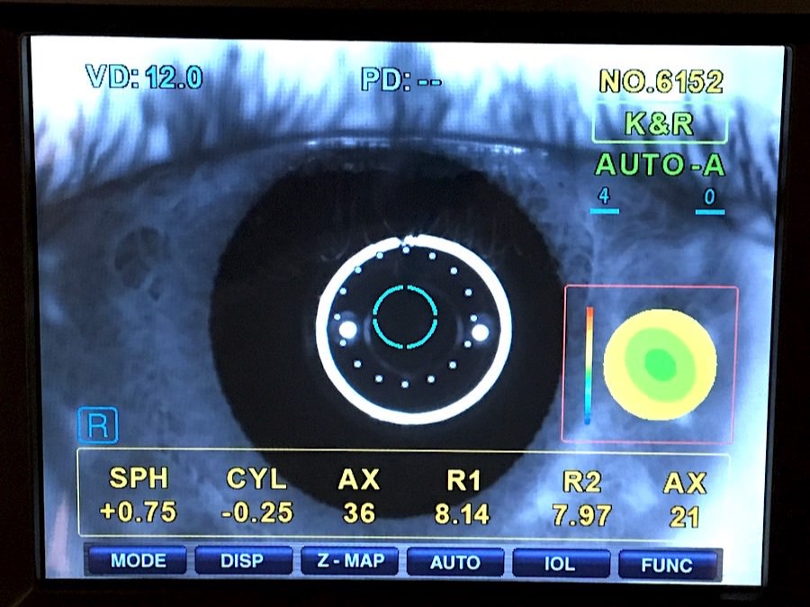 zichtmeting en oogonderzoek Dendermonde - oogarts oogtest contactlenzen bril